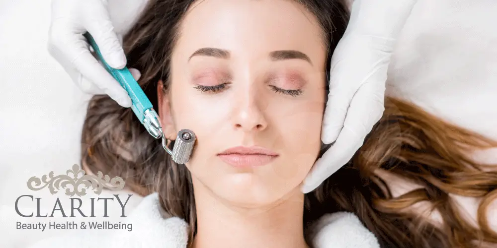 Dermal Roller Treatment in Dunfermline at Clarity House